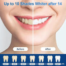 10-Pack Teeth Whitening Gel Refills - Gentle 35% Carbamide Peroxide Formula - Compatible with Teeth whitening Kit,No Sensitive Teeth Whitener by CozyNest Decor
