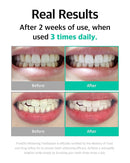 Live Orals Whitening Toothpaste 80g x 3Units - Fluoride-Free Stain Removal, Strengthens Enamel, Natural Ingredients, Fresh Mint Flavor by CozyNest Decor