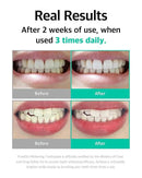 Live Orals Whitening Toothpaste 80g - Fluoride-Free Stain Removal, Strengthens Enamel, Natural Ingredients, Fresh Mint Flavor by CozyNest Decor