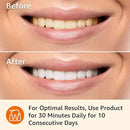 Amazon Basics 10 Day Teeth Whitening Strips Kit, 10 Treatments, 1-Pack (Previously Solimo) by CozyNest Decor