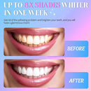 Teeth Whitening Strips White Strip - 28 Pcs Sensitive Whiten Stripe, Natural Enamel Safe Non-Slip Dry Product,30 Minutes Fast Effects Tooth Whitener,14 Treatments Mint Kit for Home Family Travel Work by CozyNest Decor