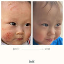 BIRTH SKINCARE Eczema Organic Baby Serum for Newborn and Infant, Redness Relief Moisturizer for Dry skin, Steroid Free 20z 59 ml Baby Ointment Body Serum for itchy Skin Relief, Made In Canada by TinyTreasures Baby Boutique