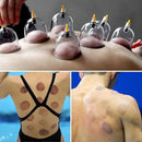 Cupping Kit for Massage Therapy - 32 Cups Professional Chinese Cupping Set with Magnetics, Vacuum Cupping Therapy Set for Cellulite Reduction Muscle Pain Relief with Manual Pump by CozyNest Decor