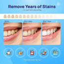 Whitebite Pro Upgraded Teeth Whitening Strips 14 Strips (7 Treatments) | Enamel-Safe | Deep Stains Removal | Non-Slip Design | Whitening Without Any Harm | Mint by CozyNest Decor