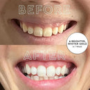MOON LED Teeth Whitening Kit - Platinum Teeth Whitener Device + 28 Dissolving White Strips - Yellow, Blue, + Red Light Therapy Whitening Tray for Gum Health and Fresh Breath (4 Piece Kit) by CozyNest Decor