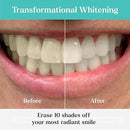 GLO Science So Brilliant Teeth Whitening Kit – Patented Warming Mouthpiece with LED Light Technology, Whitening Gel w/ 6% Hydrogen Peroxide, Lip Balm – Fastest Way to Whiter Teeth, Sensitivity Free by CozyNest Decor