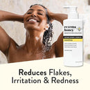 ECZEMA HONEY Nourishing Shampoo - Helps with Psoriasis, Dermatitis, & Flaking - Daily Dandruff Shampoo & Scalp Care - Itchy Scalp Treatment for Men, Women & Kids (8 Oz) by TinyTreasures Baby Boutique