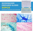 40X-2000X Microscopes for Kids Students Adults, with Microscope Prepared Slides 30p, Microscope Accessories, Phone Adapter, Microscopes for School Laboratory Home Education by TinyTreasures Baby Boutique