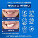 Whitening Strips for Sensitive Teeth 7 Treatments, Mint – Enamel Safe, Peroxide-Free Coconut Teeth Whitening Strips with Natural Enzymes – Gentle White Stips for Sensitive Gums & Daily Oral Care by CozyNest Decor