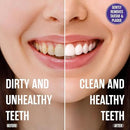SprinJene Fluoride Free Toothpaste for Sensitive Teeth & Gum Fresh Breath Helps Dry Mouth Natural Non Fluoride Toothpaste for Adult SLS Free, Toxic Preservative Free with Black Seed Oil & Zinc 4 Pack by CozyNest Decor