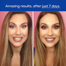 GLO Science Teeth Whitening Gel – 6% Hydrogen Peroxide – Clinically Proven, Fast & Safe for Sensitive Teeth – Includes 10 Gel Vials & 1 Lip Care by CozyNest Decor