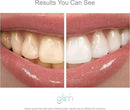 Glim Professional Teeth Whitening Strips| 42 Strips (21 Treatments), Hydrogen-Free, Peroxide-Free, Non-Toxic, Dentist Recommended, Sensitivity Free - Vegan & Cruelty Free - (Mint) by CozyNest Decor
