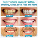 BESTEK Teeth Whitening Kit – 32X LED Light, 10-Min Fast Whitening, 4 Tubes of 35% Carbamide Peroxide Gel, Removes Coffee, Wine & Tobacco Stains - Yellow by CozyNest Decor