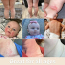 Roe Wellness- Baby Cream Lotion Ointment | Full Body Biome Barrier Cream | Clean Ingredients, Dry Skin, Itch Relief, Moisturizing, All Over Ointment | Toddlers & Kids by TinyTreasures Baby Boutique