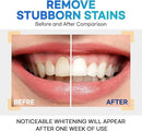 Teeth Whitening Gel – Set of 3 – Gentle, Pain-Free Formula for Sensitive Teeth – Easy, Mess-Free Application – Travel-Friendly & Enamel-Safe for a Brighter Smile by CozyNest Decor