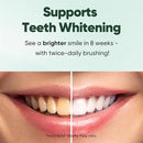 MySmile Fluoride Free Toothpaste, Nano Hydroxyapatite Toothpaste for Sensitive Teeth, Strengthens Enamel, Remineralizes & Whitens Teeth, Freshens Breath for Adults, SLS Free, Natural Misty Mint, 4.2oz by CozyNest Decor