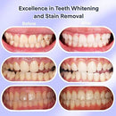 American Teeth Whitening Kit, Teeth Whitening Gel, Pen, Whitening Trays with Light, 25 Uses, Whiten Up to 8 Shades in 1 Week, 2025 Powerful Teeth Whitener by CozyNest Decor