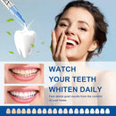 LUCKIN SMILE 10pcs Teeth Whitening Gel Refill with 35% Carbamide Peroxide Suitable for Sensitive Teeth Whitening, Teeth Whiteners Used in Conjunction with Teeth Whitening Kits by CozyNest Decor