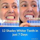 Polar MD Teeth Whitening Kit, Professional Teeth Whitener Gel Pens, 1YR. Supply, Compare to Whitening Strips. Powerful 32 LED Wireless Activating Light. by CozyNest Decor
