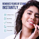 VieBeauti Teeth Whitening Kit with LED Light for Sensitive Teeth, 35% Carbamide Peroxide, Remineralizing Gel for Fast Results Mint by CozyNest Decor