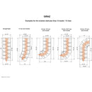 GRAZ Modular Staircase Kit