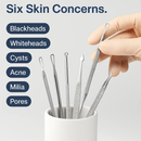 Blackhead Remover Kit for Pimples and Acne by LJGDeals