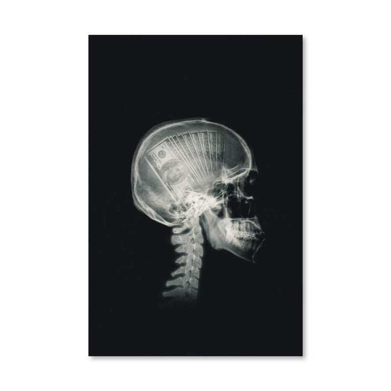 Money Mind X-ray Canvas