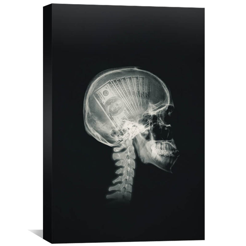 Money Mind X-ray Canvas