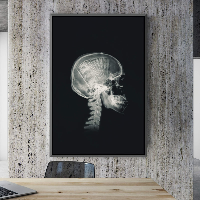 Money Mind X-ray Canvas